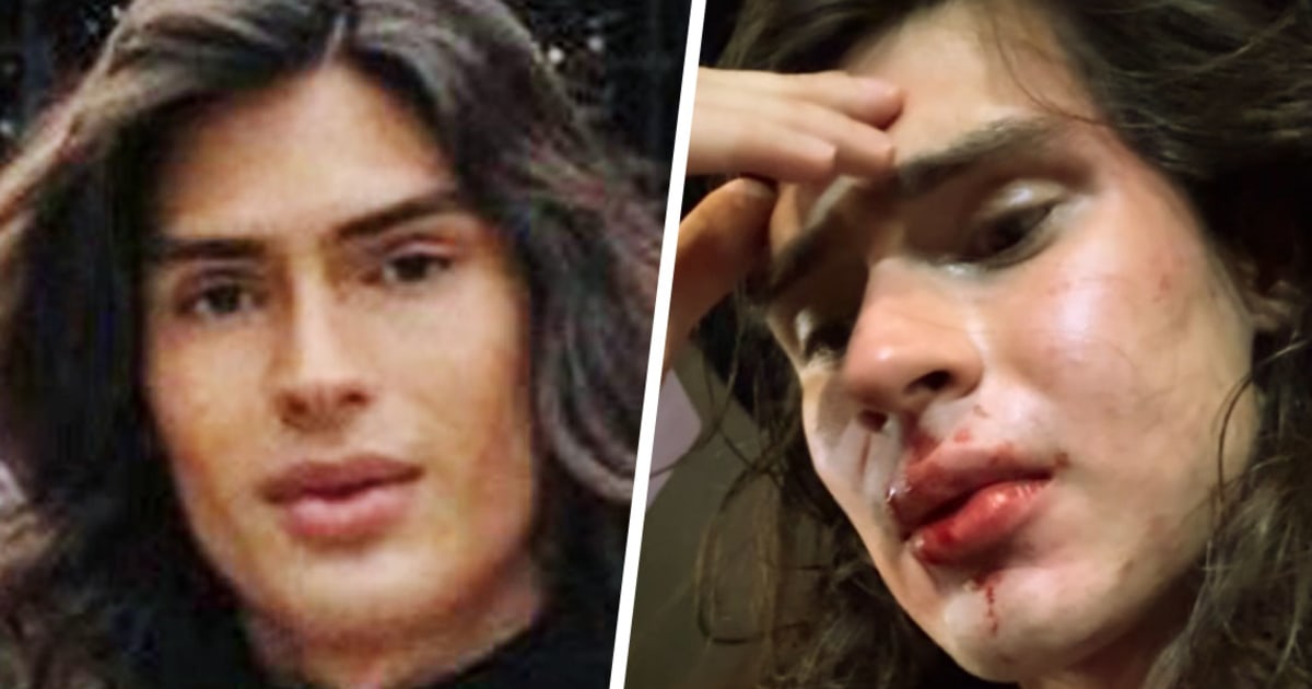 D.C. police investigate assault of gay model as a hate crime