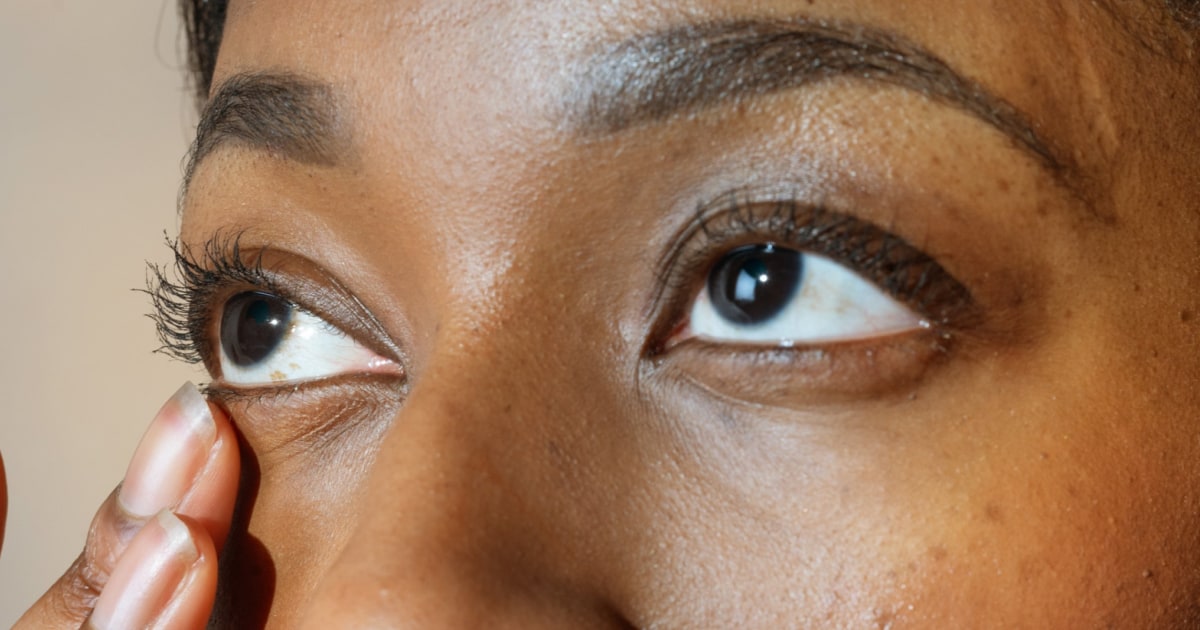 Best Stye Treatments, According to Experts
