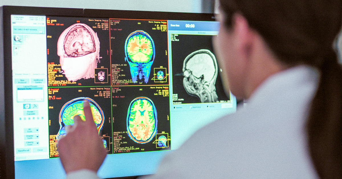 Mysterious brain diseases in Canada weren’t a mystery after all - NBC News