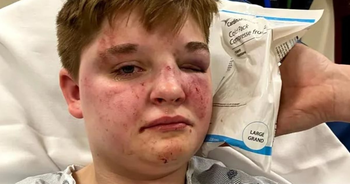 Lesbian teen brutally beaten at Illinois McDonald's