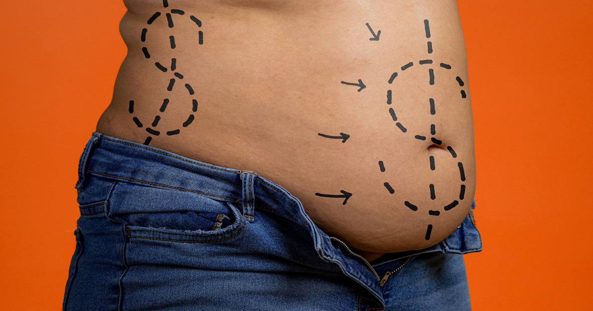 ‘I was skinned alive’: Patients say cosmetic surgery chains left them disfigured