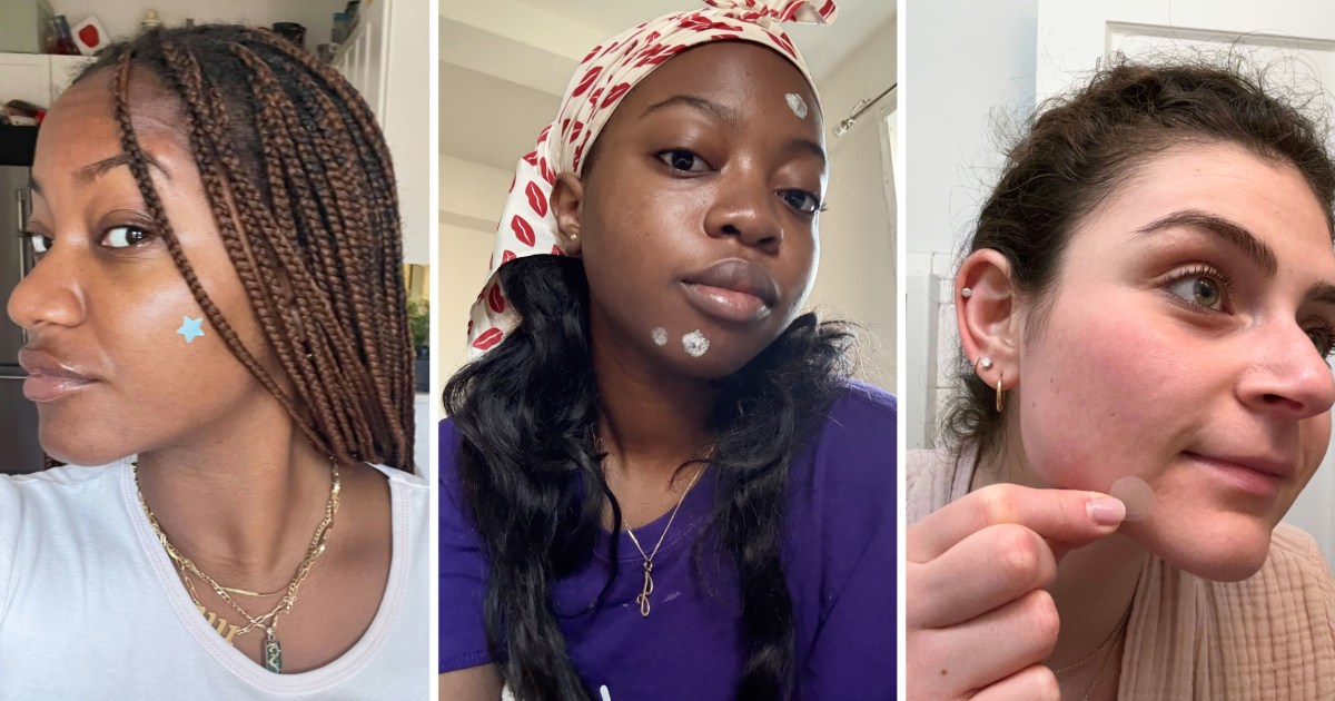 The Best Acne Spot Treatments in 2025, Tested by Editors The Best Acne Spot Treatments in 2025, Tested by Editors