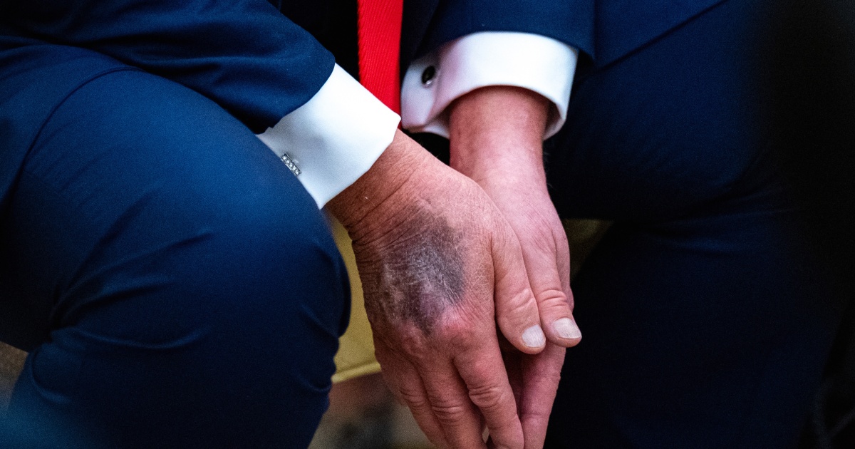 Trump, who questioned his opponents' health, rebuffs rumors about his own