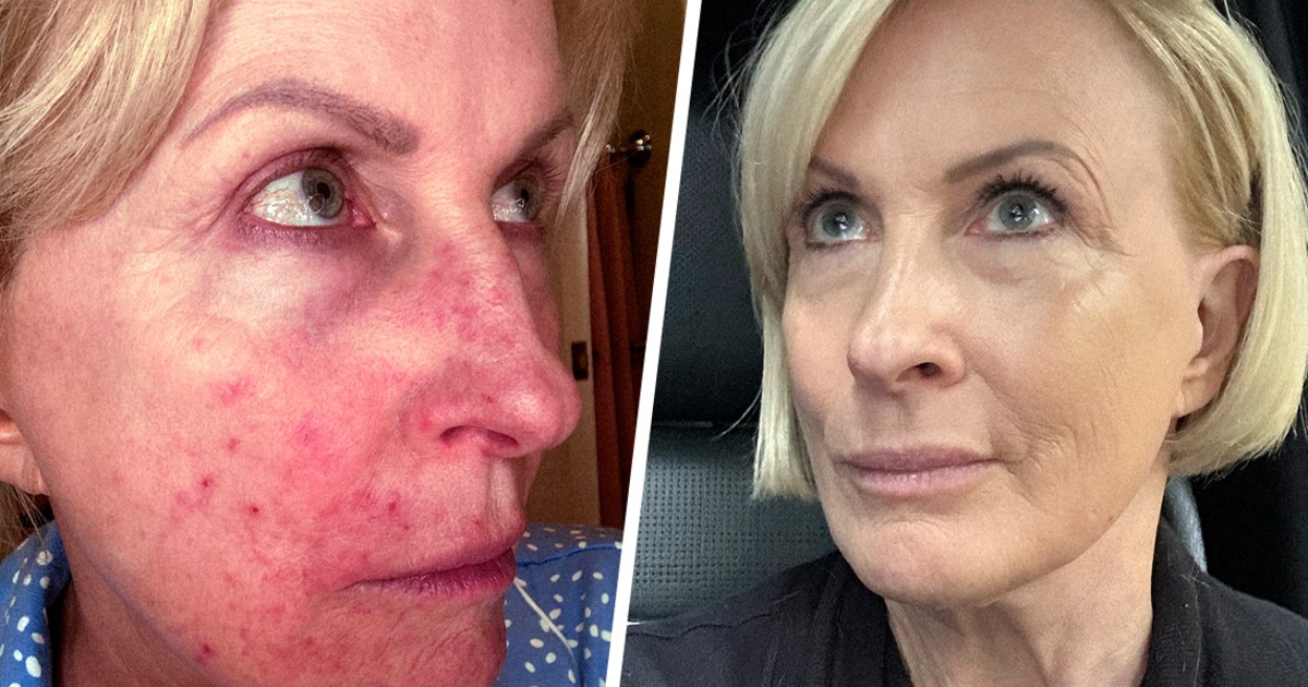 Mika shares ugly truth about products that made her sick