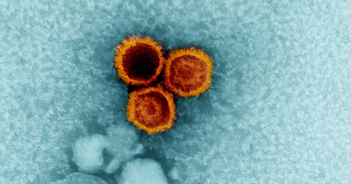 Lupus may be caused by the common Epstein-Barr virus, study finds