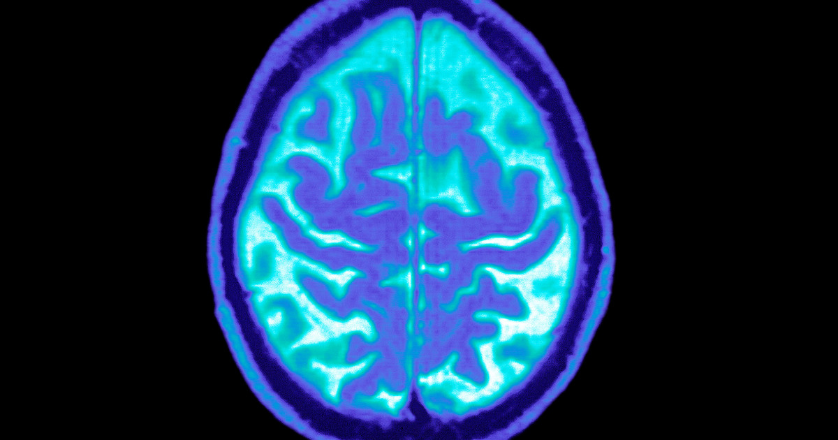 Novo Nordisk still sees potential in Ozempic for Alzheimer’s, despite trial setbacks