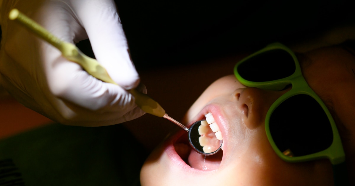 If states ban fluoride, more kids will get cavities and Medicaid costs could soar, study finds