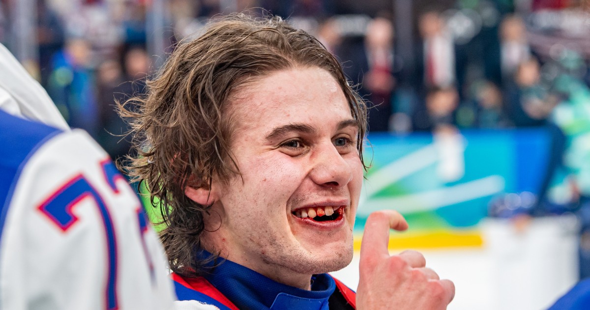 U.S. Olympic hockey hero Jack Hughes finally fixes teeth broken in gold-medal game