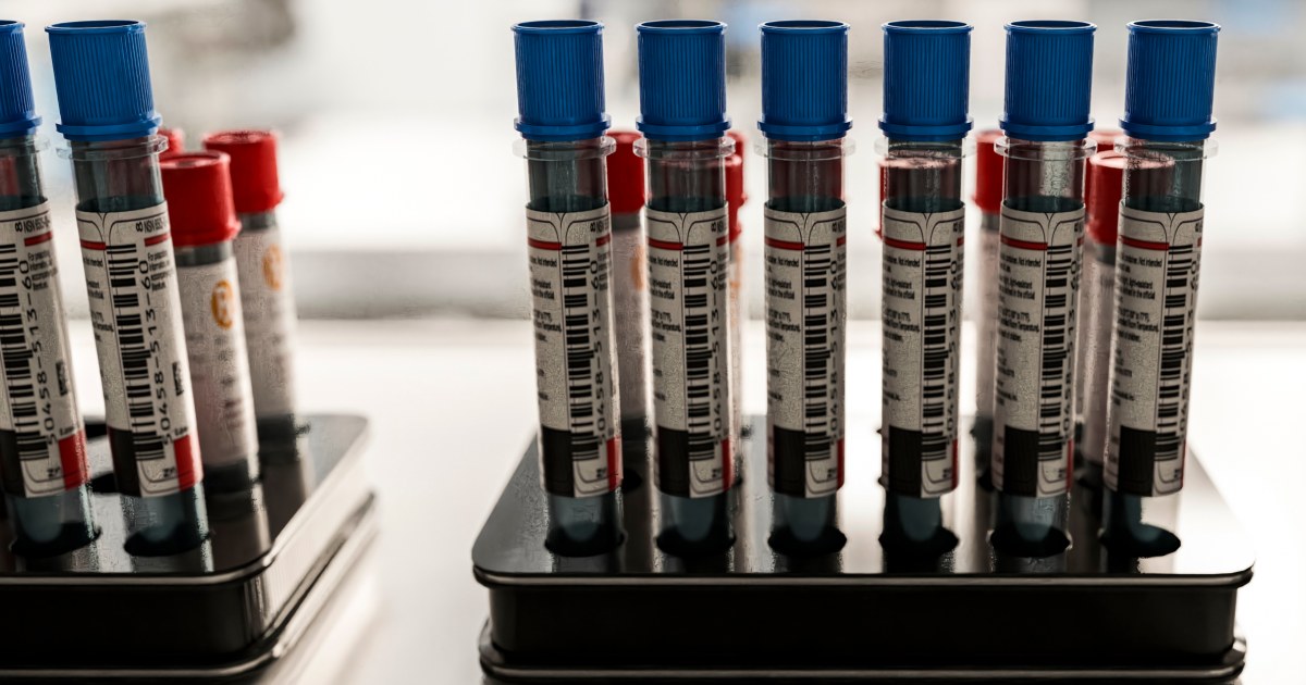 Patients Say They Want Alzheimer’s Blood Tests. Doctors Aren’t Sure They Help.