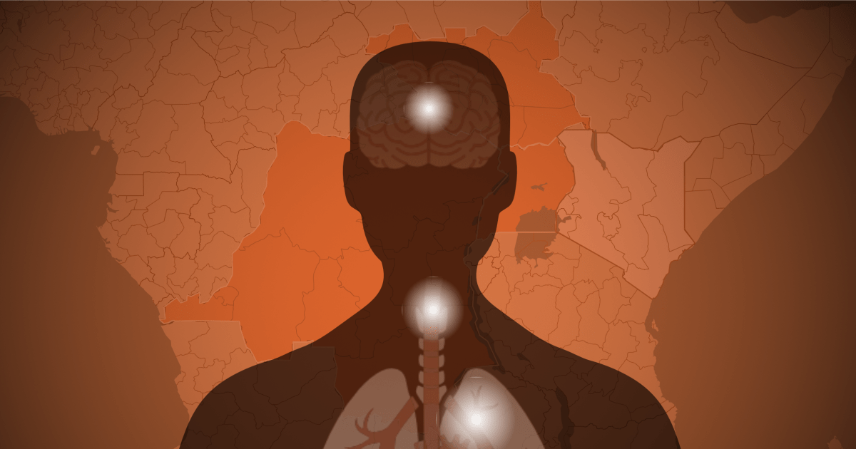 Tracking The Ebola Outbreak: Where The Deadly Virus Is Spreading And How The U.s. Is Responding - Beritaja