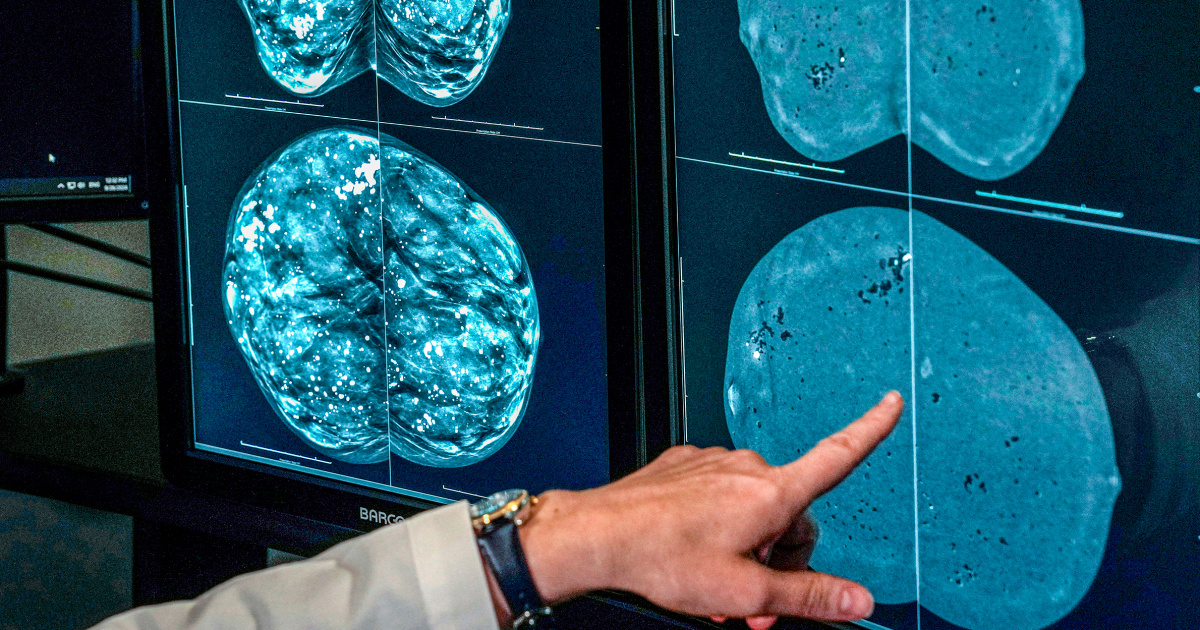 When should you get a mammogram? Conflicting advice makes it hard to know When should you get a mammogram? Conflicting advice makes it hard to know