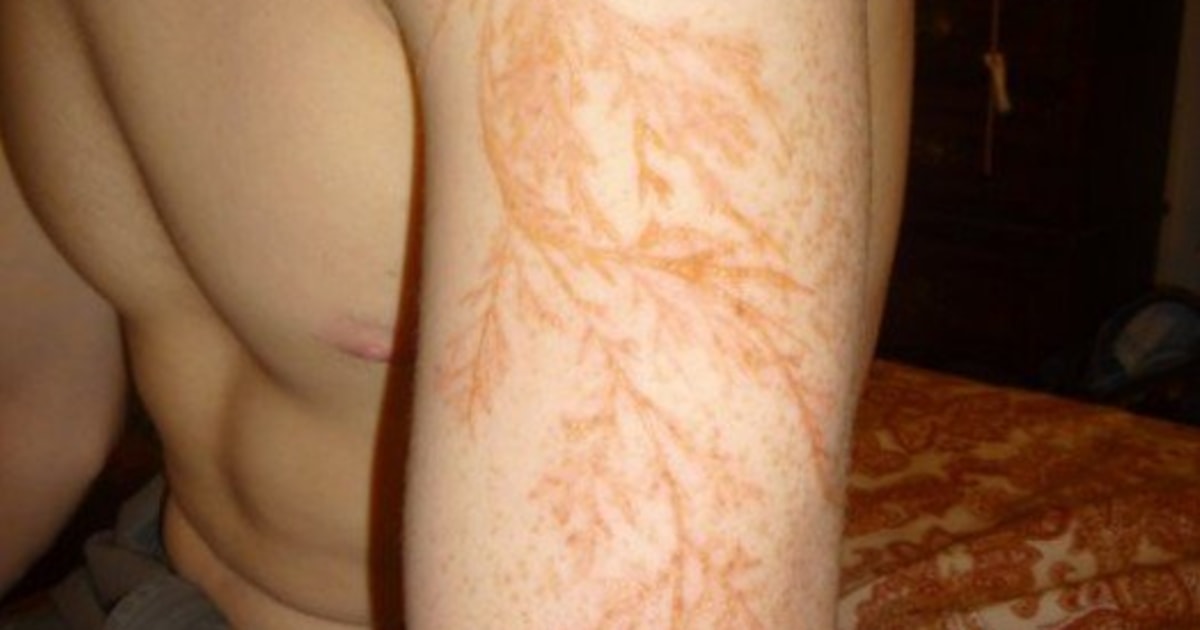 Lightning bolt sunflower tattoo on the inner arm