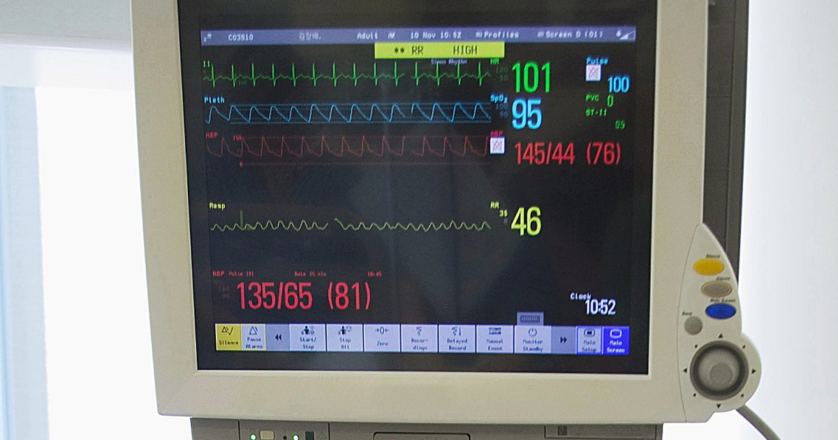 Code Blue Efforts To Re Start The Heart Can Go A Little Longer Study Finds