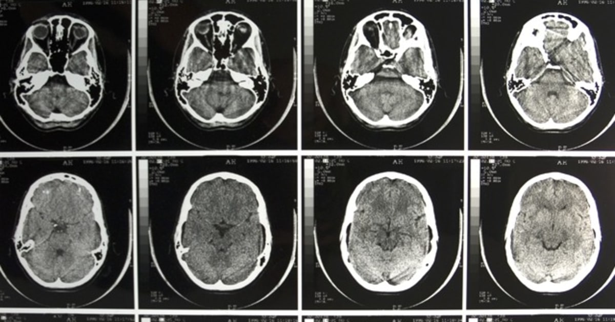 Myth, busted: You only use 10 percent of brain