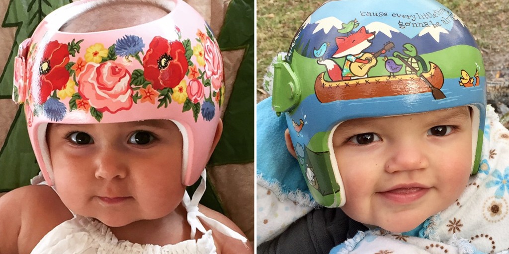 Why does some babies wear helmets information hostalelportalico