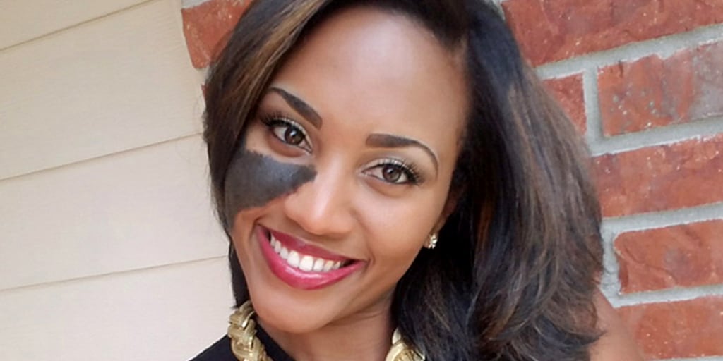 Ferrin Roy on how she learned to love her birthmark