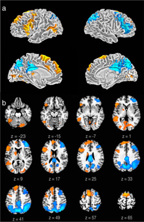 How The Brain Lets Rappers Bust Freestyle Rhymes On The Spot