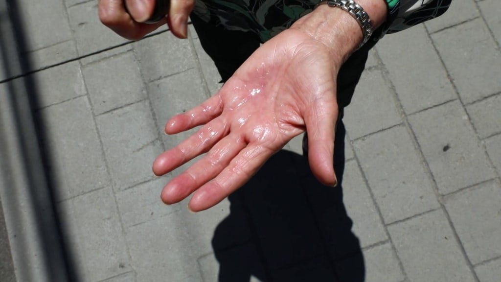 Methanol in online hand sanitizers