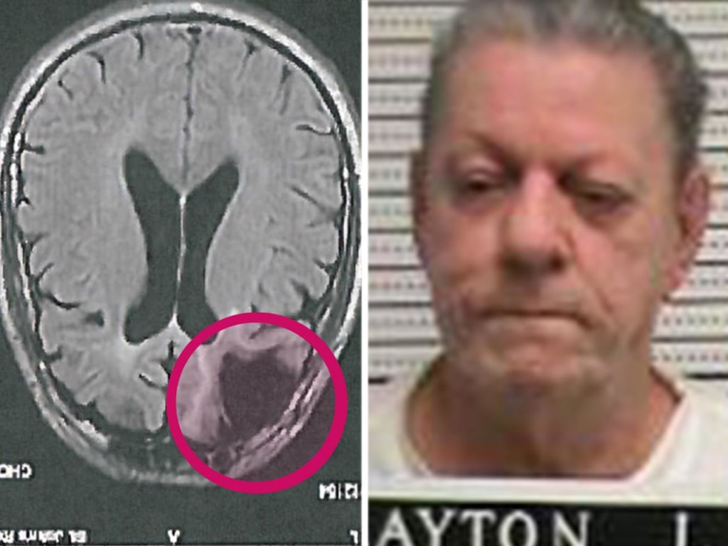 “Missouri Prepared to Execute Cecil Clayton — Even After Losing Part of His Brain in a Horrific Accident”