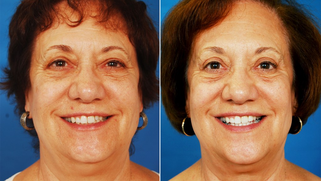 Can Plastic Surgery Make People Like You Better