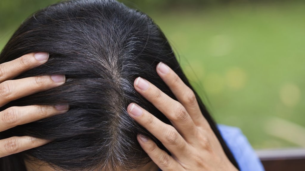 With resistant head lice rampant, prescription meds are best