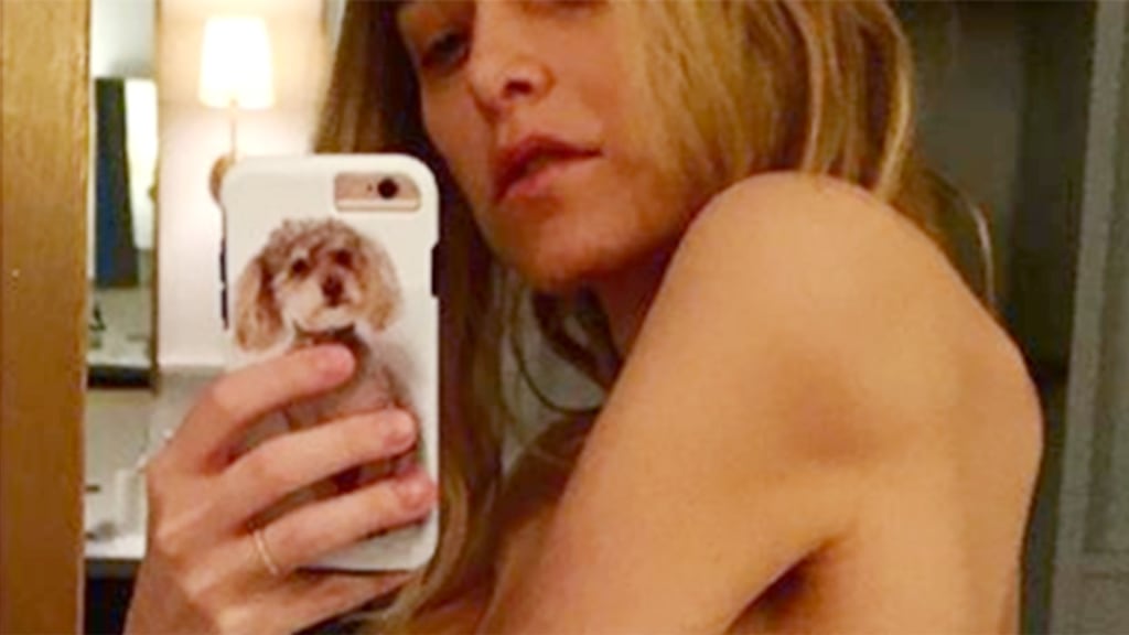 Jenny Mollen's dramatic photo shows weight loss from Graves'
