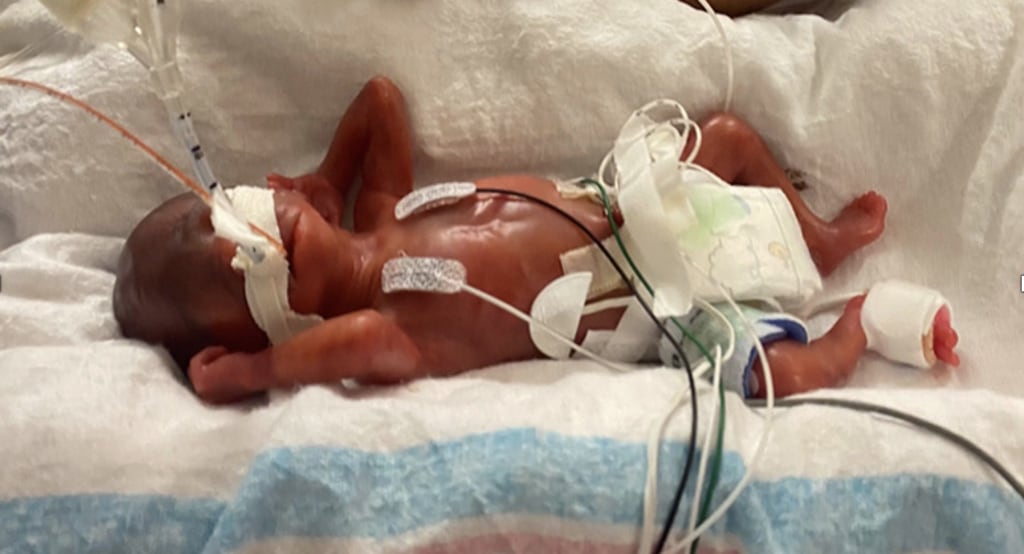 7 week hot sale premature baby