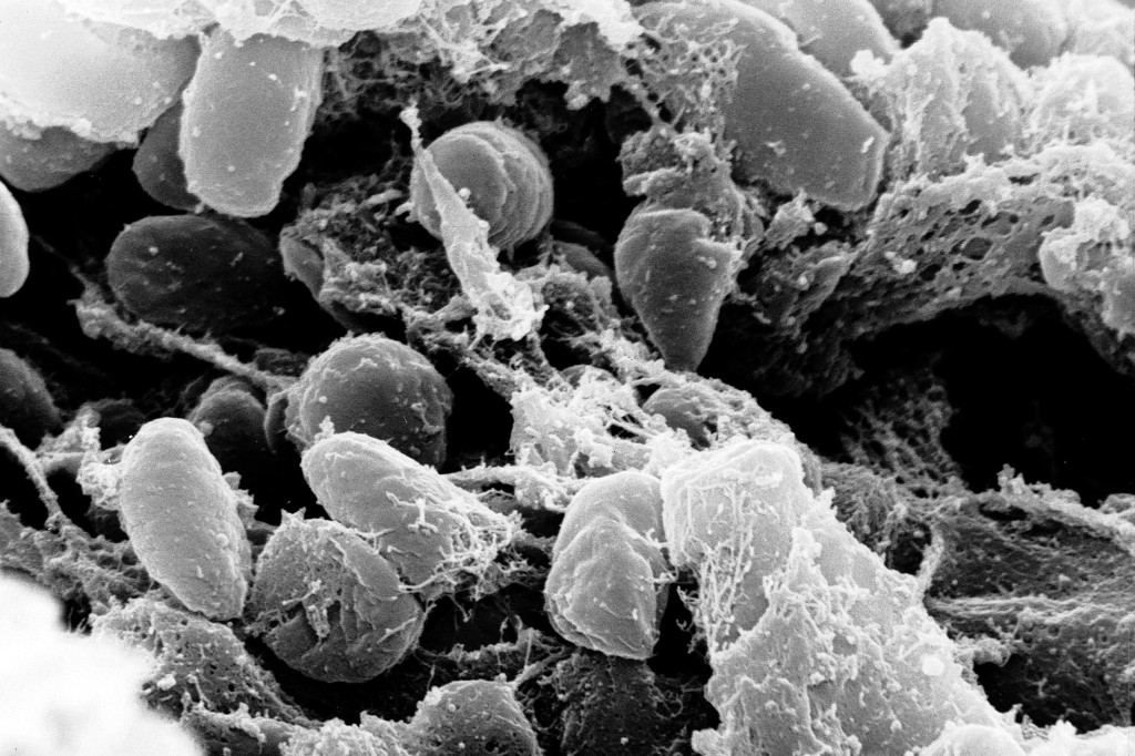 California resident catches the plague, likely from infected flea at Lake Tahoe, officials say 