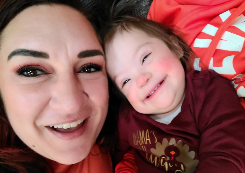 Woman Is Diagnosed With Down Syndrome as an Adult After Warning Signs
