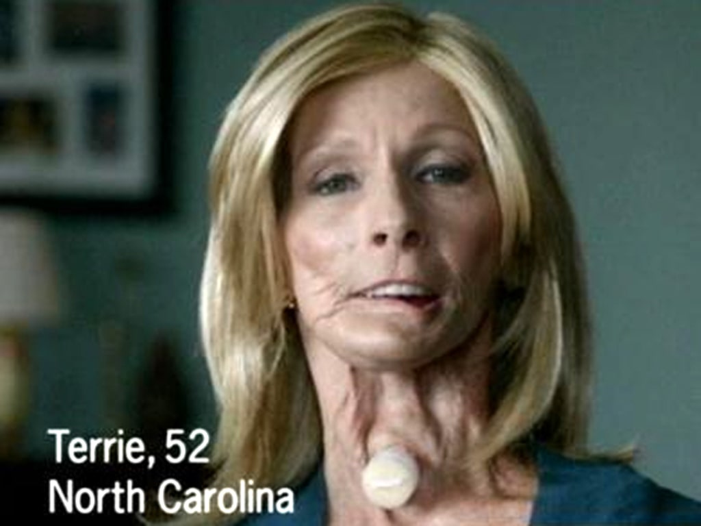 Cancer patient featured in stark CDC anti-smoking ads dies