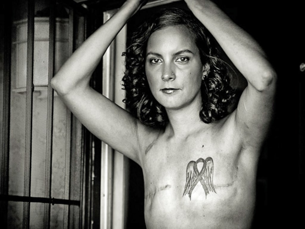Here's your f***ing breast cancer awareness' Woman shows red raw scars from  radiation