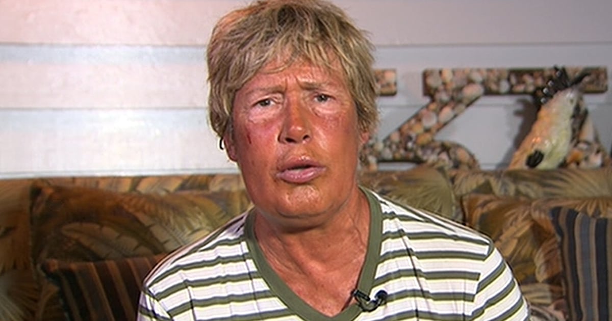 Diana Nyad: 'I was sick as a dog' during historic swim