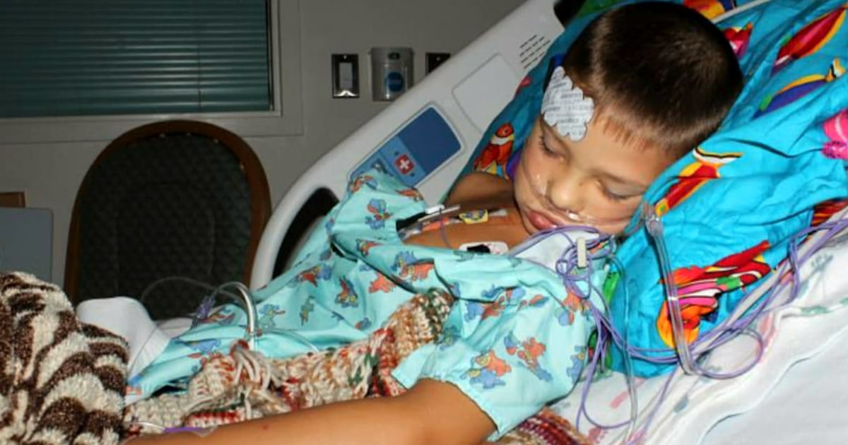 Millions show support for young boy with scars