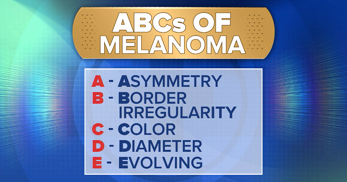 How to protect yourself from melanoma