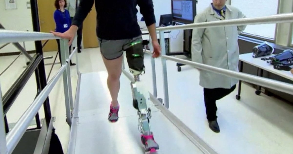 Scientists develop a bionic leg that’s controlled by thoughts