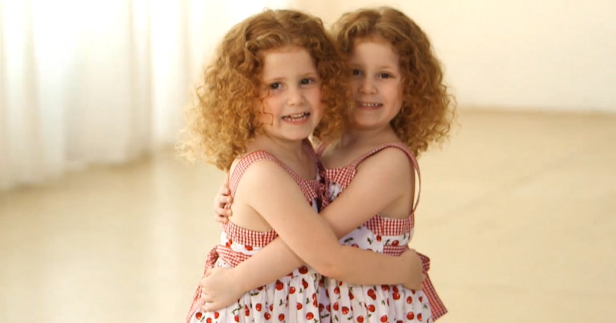 Twins explain their special bonds