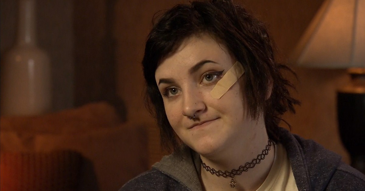 Autumn Veatch, teen plane crash survivor, shares tale of survival