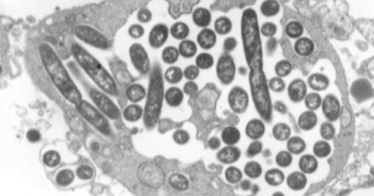 How dangerous is Legionnaires’ disease outbreak in NYC?