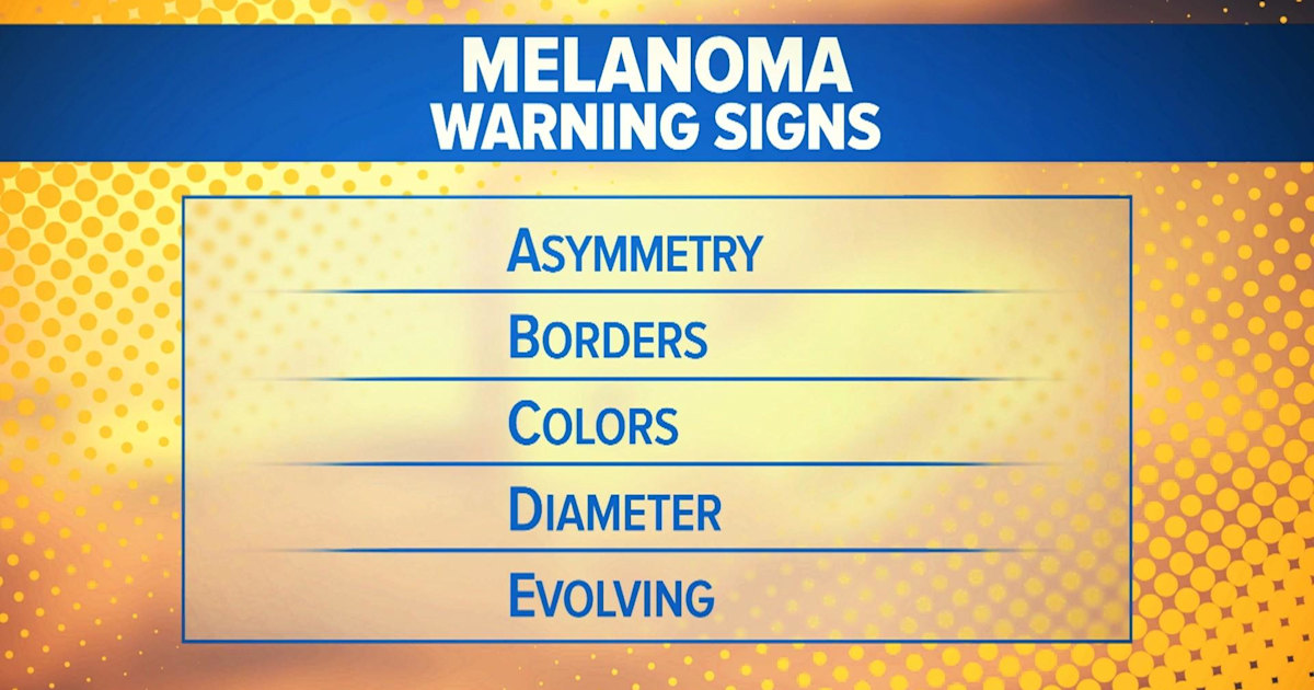 Melanoma cases caused by sun exposure are rising in US, report says
