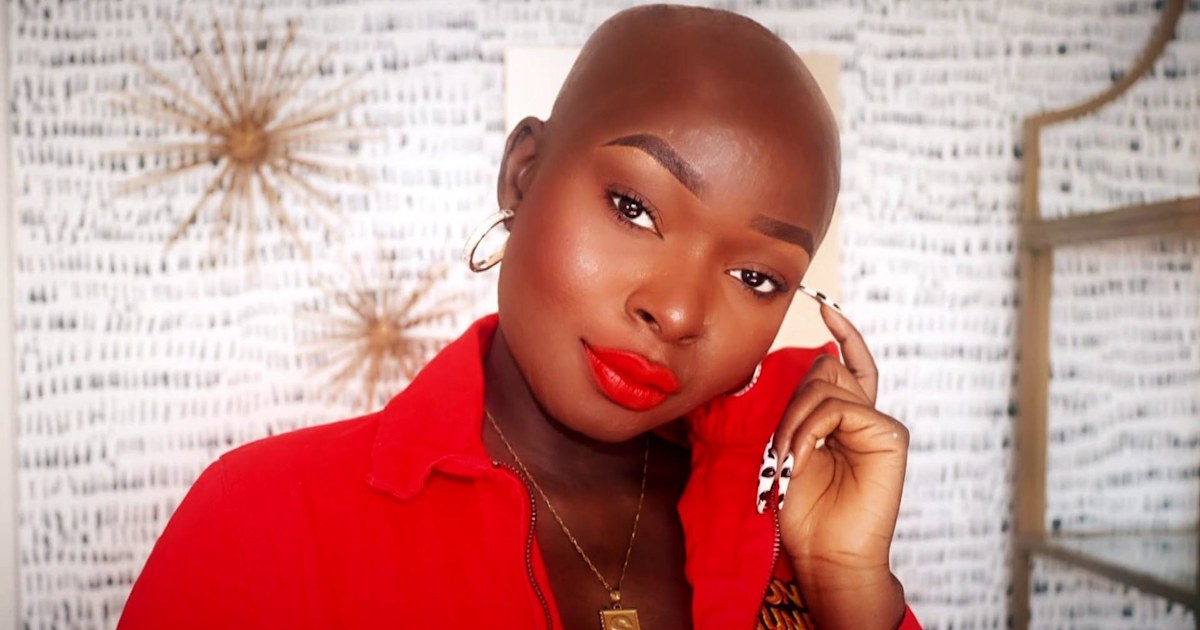 Shalom Blac, a burn survivor, encourages others to embrace their beauty