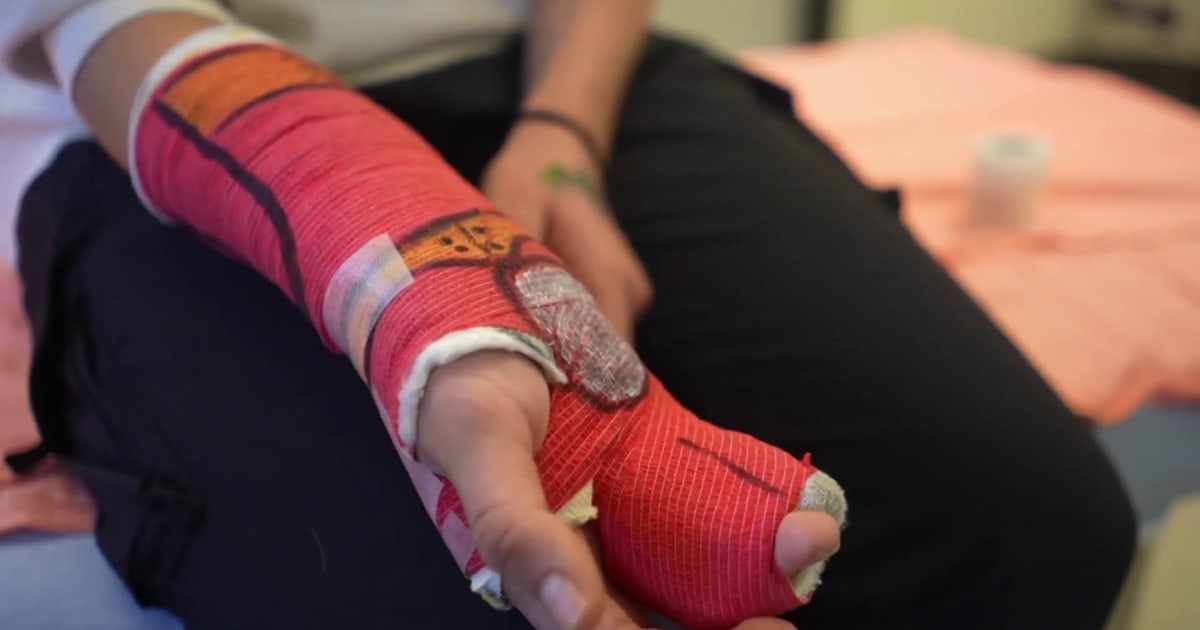 This medical worker puts smiles on young patients faces with cast art