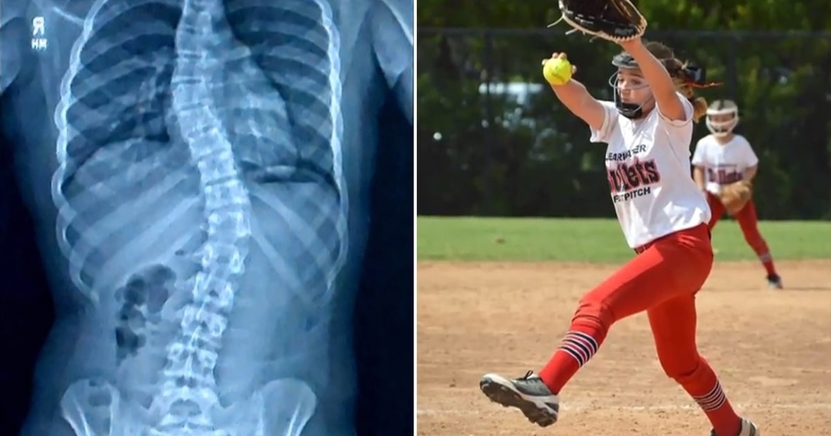 Teen’s Health Journey Fuels Her Passion for Softball