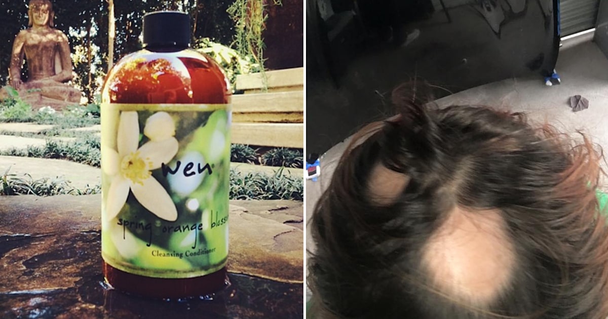 FDA launches WEN by Chaz Dean hair loss investigation