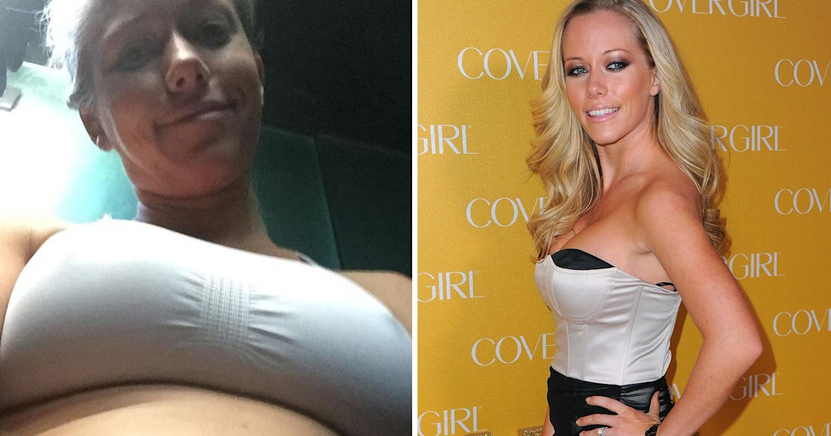 Kendra Wilkinson Baskett Shares Candid Photo Of Stretch Marks On Mother S Day I am cherishing every moment with him. related: kendra wilkinson baskett shares candid