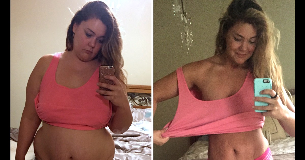What It S Like To Really Lose Over 100 Pounds
