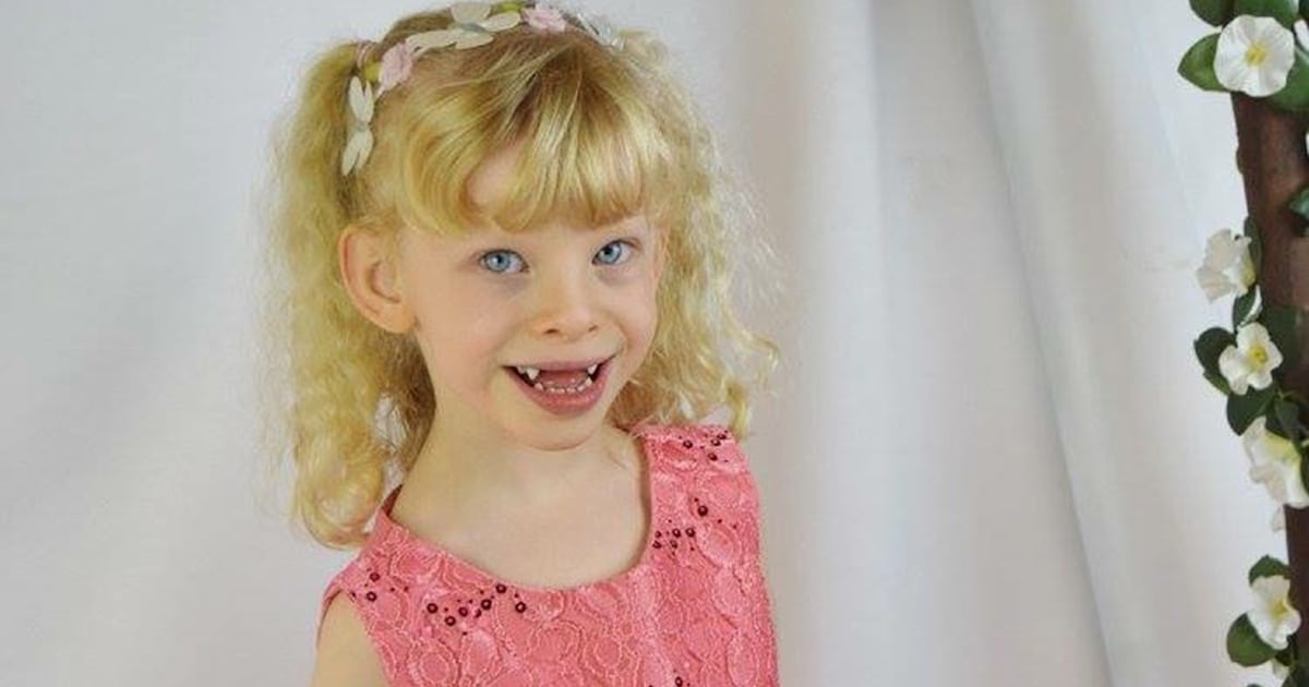 Williams syndrome means health issues, outgoing personality