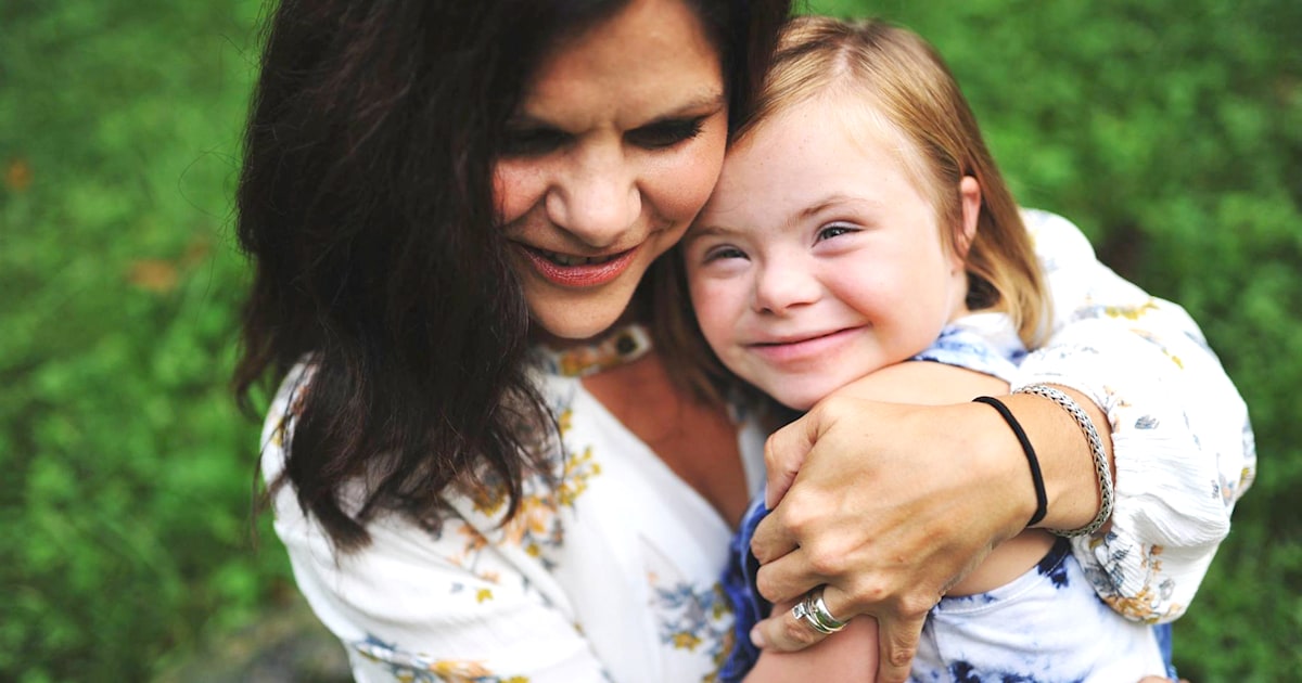 'Changing the Face of Beauty' Katie Driscoll fights for media inclusion