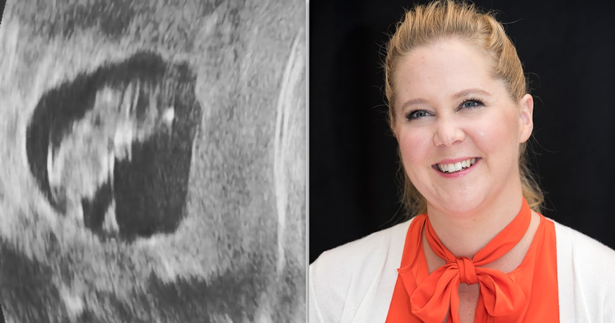 Amy Schumer Shares Another Pregnancy Pic To Explain Why Shes Bumping Tour Dates | HuffPost 