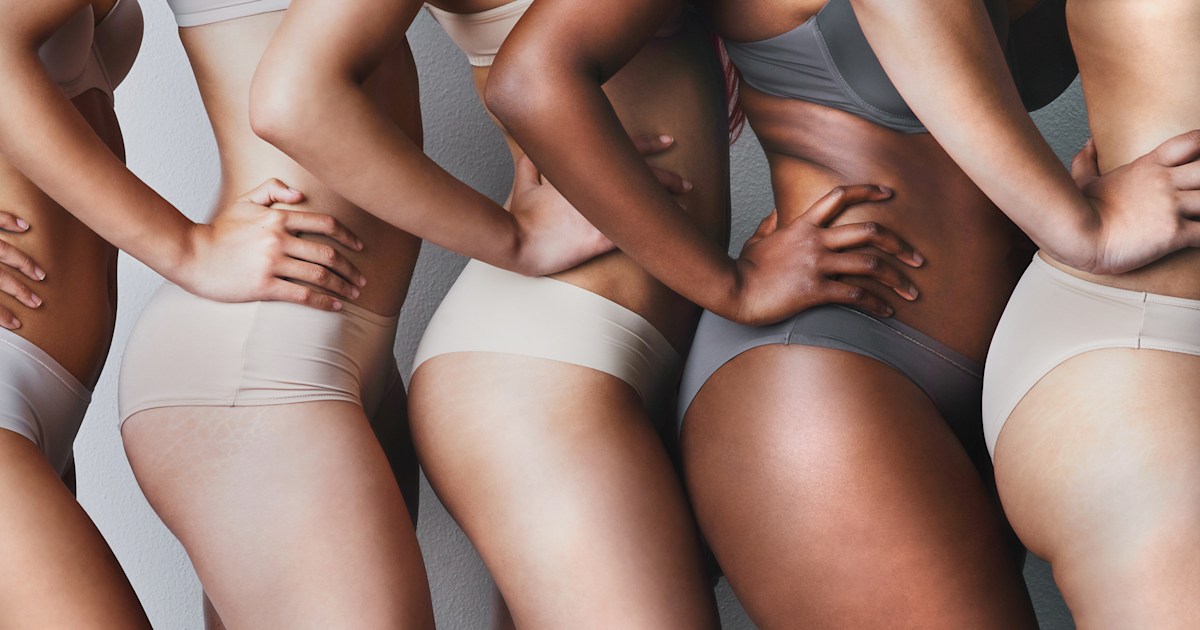 BioOil review Can BioOil help with scars and stretch marks?