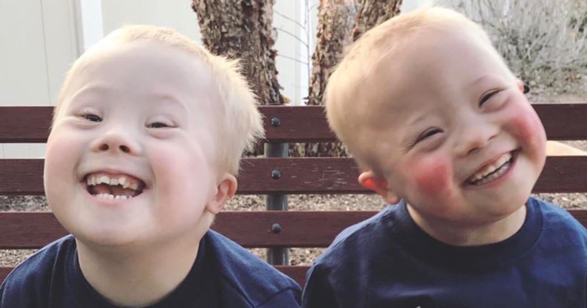 Mosaic down syndrome: Definition, symptoms, and diagnosis